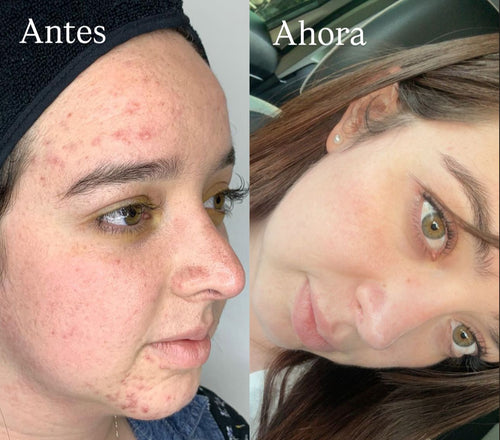 Crema Piel de Porcelana