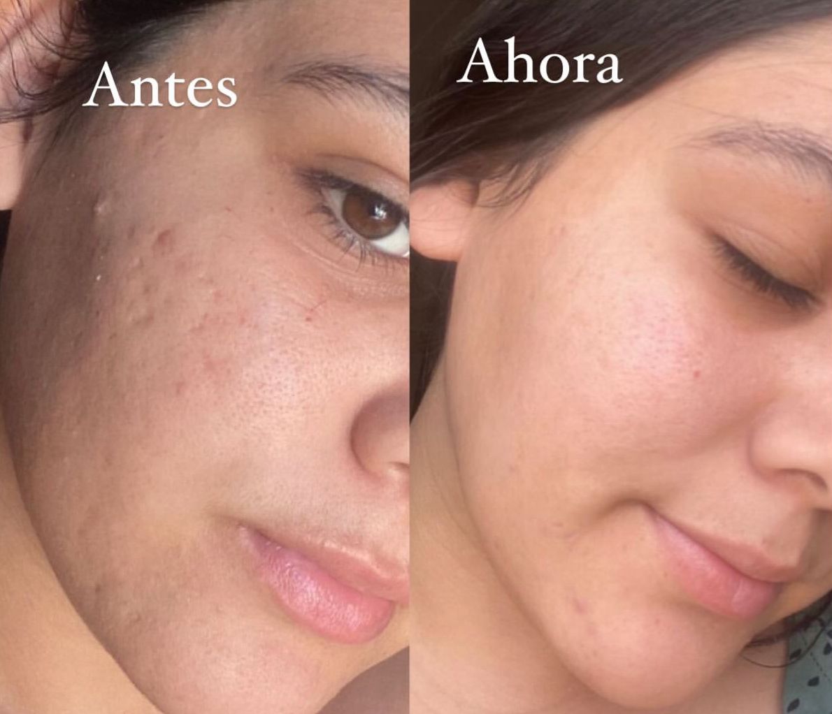 Crema Piel de Porcelana