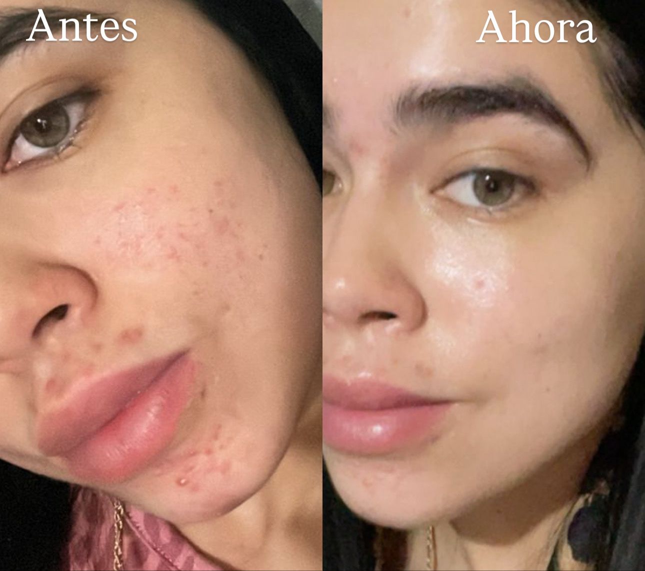 Crema Piel de Porcelana